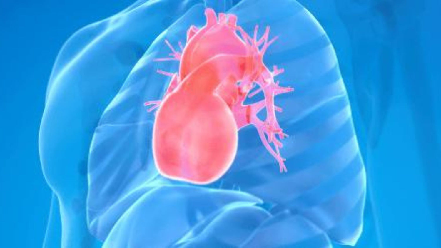 High Lp(a) warrants intervention, even without other cardiovascular risk factors